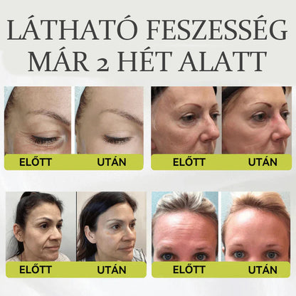 🌱🌱Büszkén az Európai Unióban gyártva 💫 Tiworld® fejlett peptid Botox-hatású + Vita-A retinol feszesítő megújító krém – ma csak 70% KEDVEZMÉNNYEL
