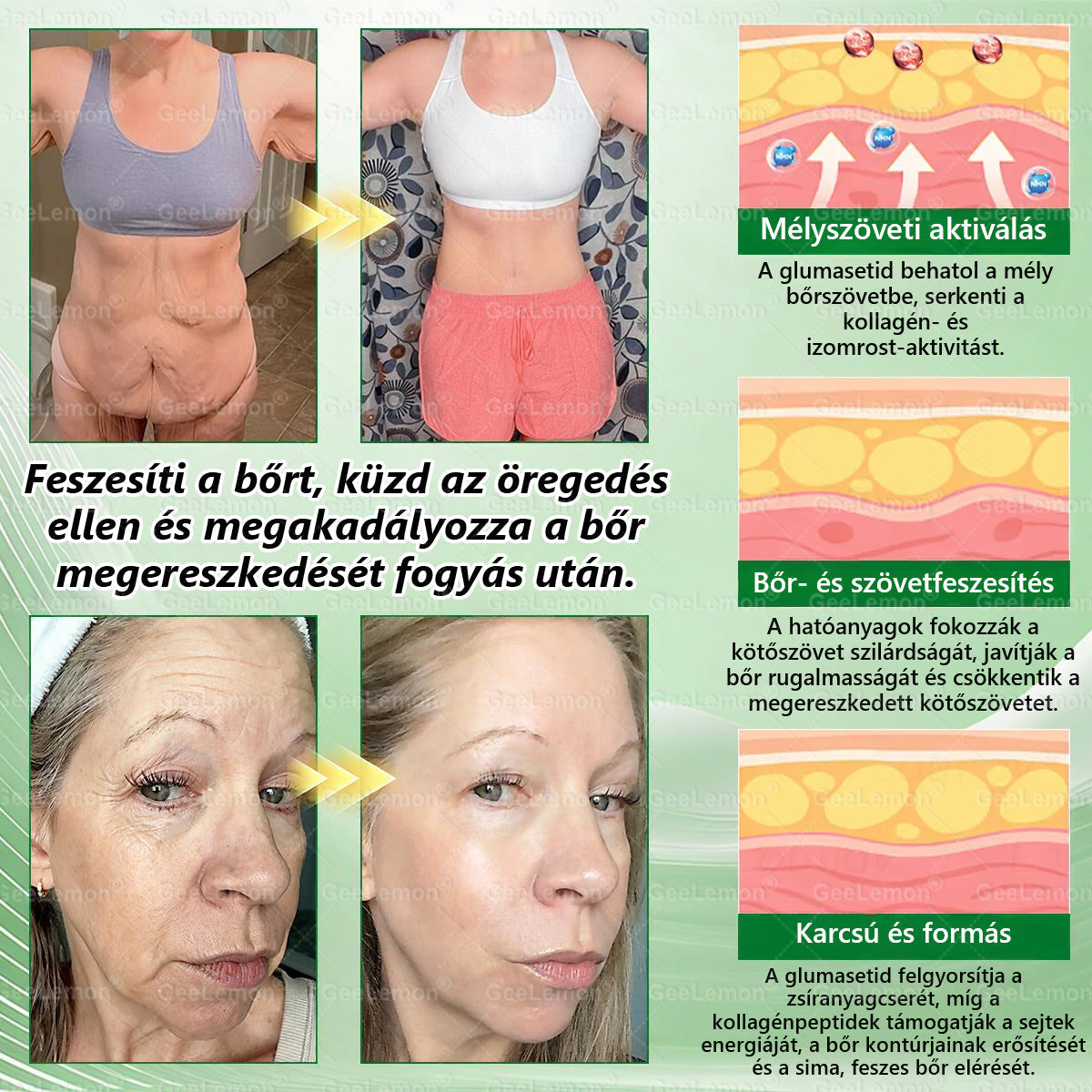 ✅✨Moringa · Berberine × NAD+ 10-in-1 Advanced Nano GeeLemon® Glumasetide 8az 1-ben Karcsú és EgészségesNano Mikrotűs Tapasz (Napi 1alkalom – látható változásakár 7 nap alatt) ✅ Elhízásra,bőrfeszesítésre,cukorbetegségre, alvásiapnoéra, ízületekre stb HU