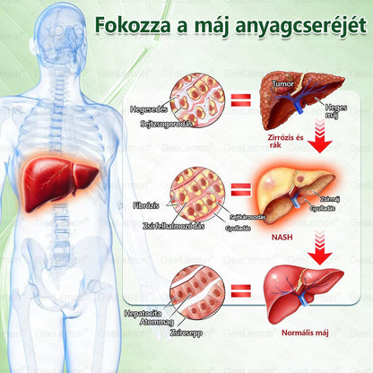 ✅✨Moringa · Berberine × NAD+ 10-in-1 Advanced Nano GeeLemon® Glumasetide 8az 1-ben Karcsú és EgészségesNano Mikrotűs Tapasz (Napi 1alkalom – látható változásakár 7 nap alatt) ✅ Elhízásra,bőrfeszesítésre,cukorbetegségre, alvásiapnoéra, ízületekre stb HU