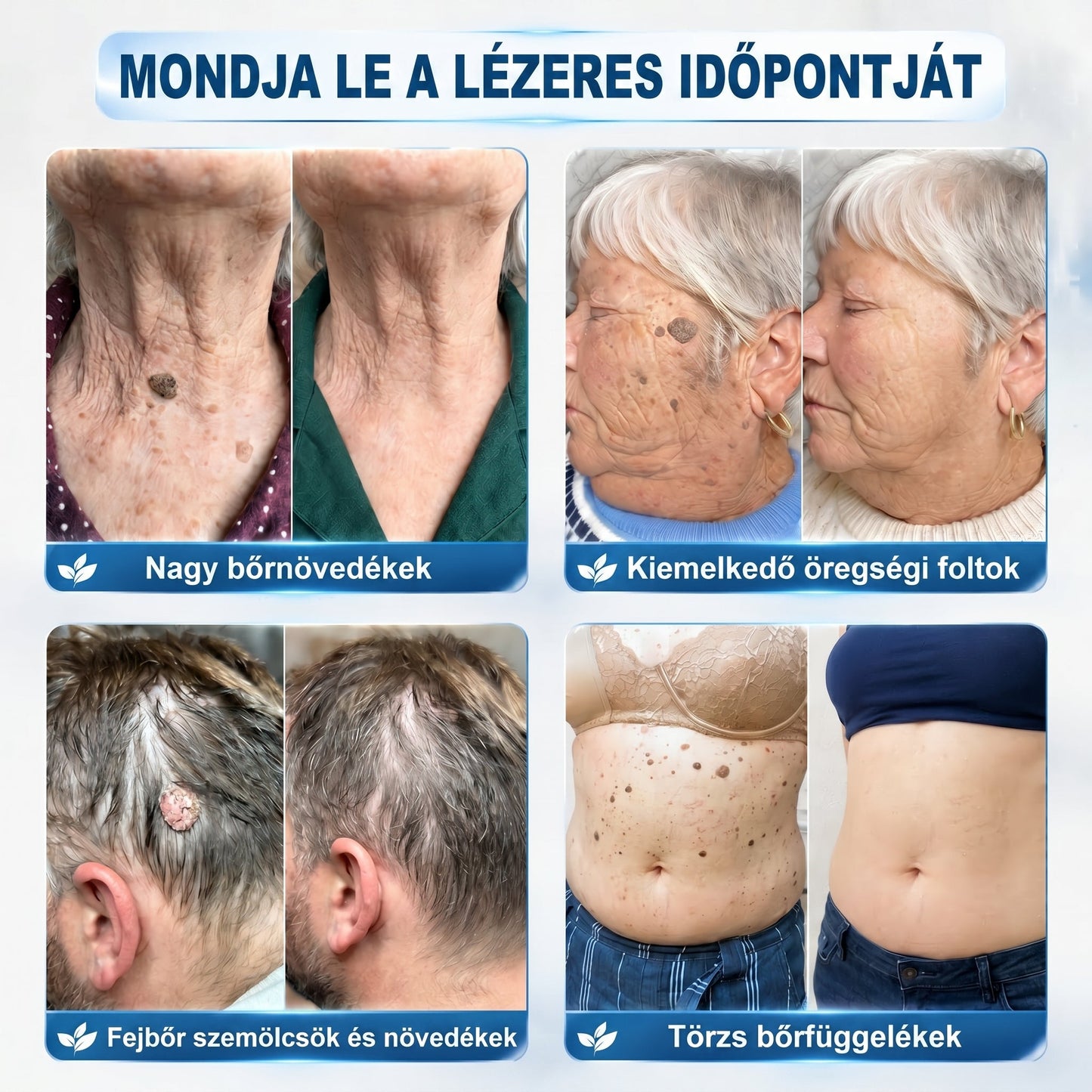 𝐇𝐢𝐯𝐚𝐭𝒂𝒍𝒐𝒔 𝒎á𝗿𝗸𝗮𝗯𝗼𝗹𝐭 | 🖊️ 𝐏i𝐜𝐝𝐨® 𝟕 𝐧𝐚𝒑𝒐𝒔 𝒔𝒛𝗲𝗺ö𝗹𝗰𝘀- é𝐬 𝐟𝐨𝐥𝐭𝐞𝐥í𝐭ó (𝐟á𝐣𝐝𝐚𝐥𝒐𝒎𝒎𝒆𝒏𝒕𝒆𝒔, 𝒉𝒆𝗴 𝗻é𝗹𝗸ü𝐥𝐢 𝐠𝐨𝐥𝐲ó𝐬 𝐚𝐩𝐩𝐥𝐢𝐤á𝐭𝐨𝐫)🌳