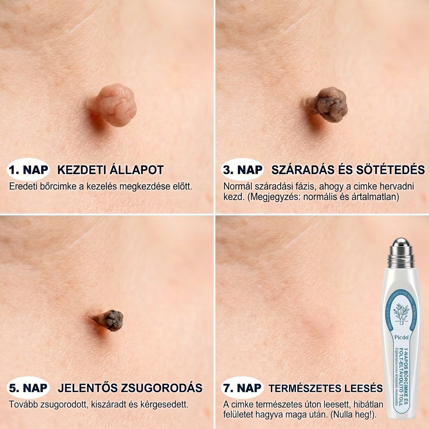 𝐇𝐢𝐯𝐚𝐭𝒂𝒍𝒐𝒔 𝒎á𝗿𝗸𝗮𝗯𝗼𝗹𝐭 | 🖊️ 𝐏i𝐜𝐝𝐨® 𝟕 𝐧𝐚𝒑𝒐𝒔 𝒔𝒛𝗲𝗺ö𝗹𝗰𝘀- é𝐬 𝐟𝐨𝐥𝐭𝐞𝐥í𝐭ó (𝐟á𝐣𝐝𝐚𝐥𝒐𝒎𝒎𝒆𝒏𝒕𝒆𝒔, 𝒉𝒆𝗴 𝗻é𝗹𝗸ü𝐥𝐢 𝐠𝐨𝐥𝐲ó𝐬 𝐚𝐩𝐩𝐥𝐢𝐤á𝐭𝐨𝐫)🌳