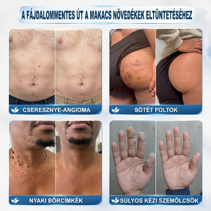 𝐇𝐢𝐯𝐚𝐭𝒂𝒍𝒐𝒔 𝒎á𝗿𝗸𝗮𝗯𝗼𝗹𝐭 | 🖊️ 𝐏i𝐜𝐝𝐨® 𝟕 𝐧𝐚𝒑𝒐𝒔 𝒔𝒛𝗲𝗺ö𝗹𝗰𝘀- é𝐬 𝐟𝐨𝐥𝐭𝐞𝐥í𝐭ó (𝐟á𝐣𝐝𝐚𝐥𝒐𝒎𝒎𝒆𝒏𝒕𝒆𝒔, 𝒉𝒆𝗴 𝗻é𝗹𝗸ü𝐥𝐢 𝐠𝐨𝐥𝐲ó𝐬 𝐚𝐩𝐩𝐥𝐢𝐤á𝐭𝐨𝐫)🌳