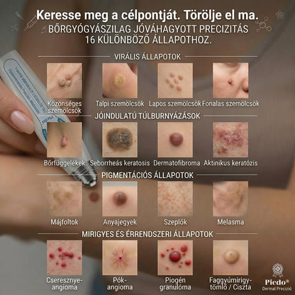 𝐇𝐢𝐯𝐚𝐭𝒂𝒍𝒐𝒔 𝒎á𝗿𝗸𝗮𝗯𝗼𝗹𝐭 | 🖊️ 𝐏i𝐜𝐝𝐨® 𝟕 𝐧𝐚𝒑𝒐𝒔 𝒔𝒛𝗲𝗺ö𝗹𝗰𝘀- é𝐬 𝐟𝐨𝐥𝐭𝐞𝐥í𝐭ó (𝐟á𝐣𝐝𝐚𝐥𝒐𝒎𝒎𝒆𝒏𝒕𝒆𝒔, 𝒉𝒆𝗴 𝗻é𝗹𝗸ü𝐥𝐢 𝐠𝐨𝐥𝐲ó𝐬 𝐚𝐩𝐩𝐥𝐢𝐤á𝐭𝐨𝐫)🌳