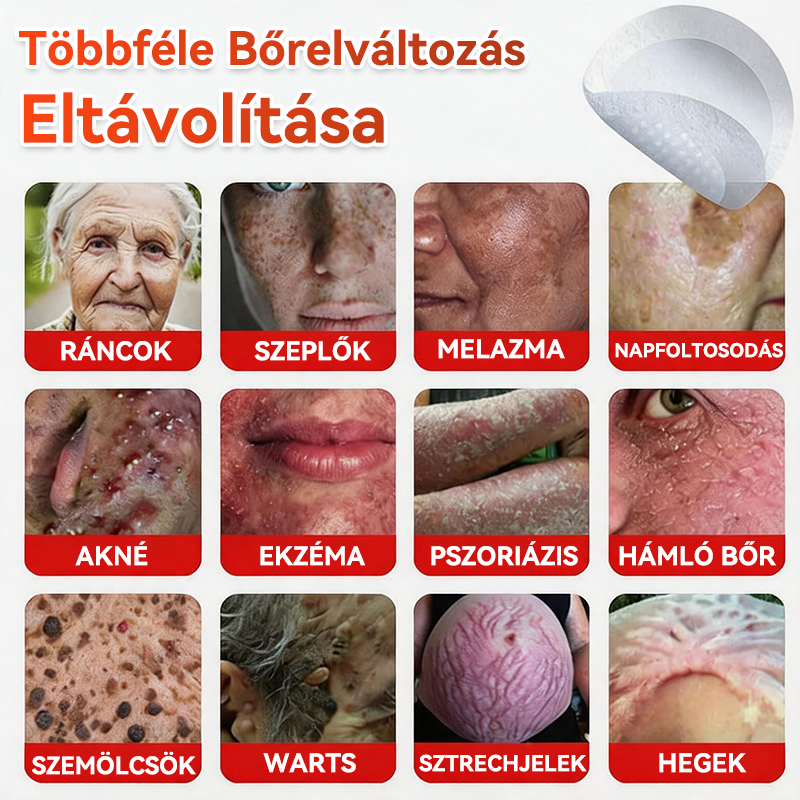 ✅ GFOUK® Mikrotűs növényi bőrkinövés eltávolító tapasz