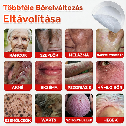 ✅ GFOUK® Mikrotűs növényi bőrkinövés eltávolító tapasz