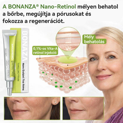 🌱🌱Büszkén az Európai Unióban gyártva 💫 Tiworld® fejlett peptid Botox-hatású + Vita-A retinol feszesítő megújító krém – ma csak 70% KEDVEZMÉNNYEL