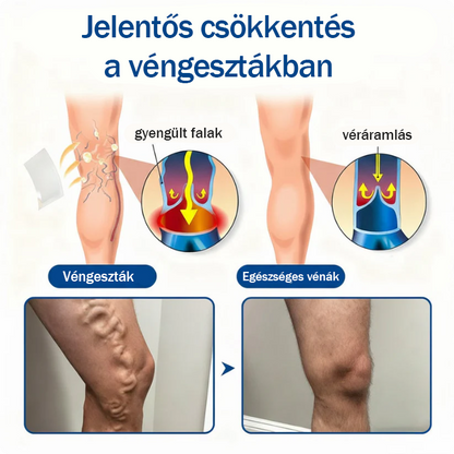 ✅🇭🇺👨‍⚕️TAILEDEN® VeinEase Mikrotűs Kezelő Tapasz⚡Azonnali Megkönnyebbülés, Hosszú Távú Eredmények