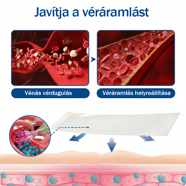 ✅🇭🇺👨‍⚕️TAILEDEN® VeinEase Mikrotűs Kezelő Tapasz⚡Azonnali Megkönnyebbülés, Hosszú Távú Eredmények