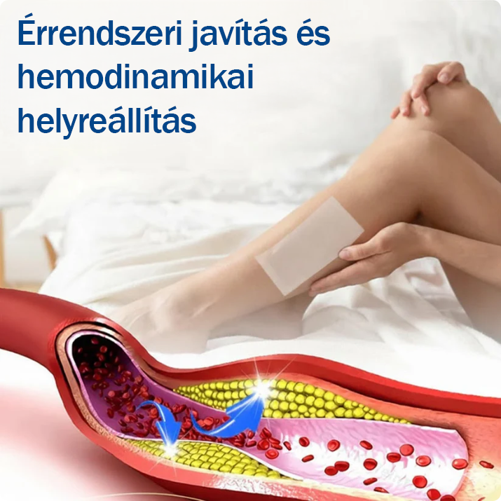 ✅🇭🇺👨‍⚕️TAILEDEN® VeinEase Mikrotűs Kezelő Tapasz⚡Azonnali Megkönnyebbülés, Hosszú Távú Eredmények