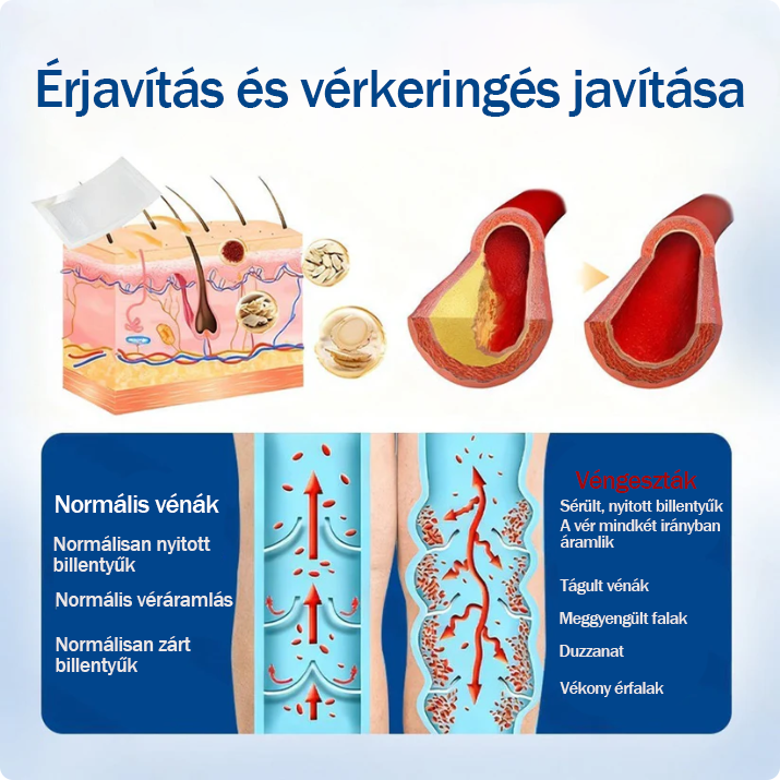 ✅🇭🇺👨‍⚕️TAILEDEN® VeinEase Mikrotűs Kezelő Tapasz⚡Azonnali Megkönnyebbülés, Hosszú Távú Eredmények
