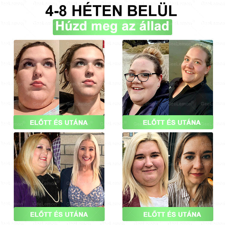 ✅✨Moringa · Berberine × NAD+ 10-in-1 Advanced Nano GeeLemon® Glumasetide 8az 1-ben Karcsú és EgészségesNano Mikrotűs Tapasz (Napi 1alkalom – látható változásakár 7 nap alatt) ✅ Elhízásra,bőrfeszesítésre,cukorbetegségre, alvásiapnoéra, ízületekre stb HU