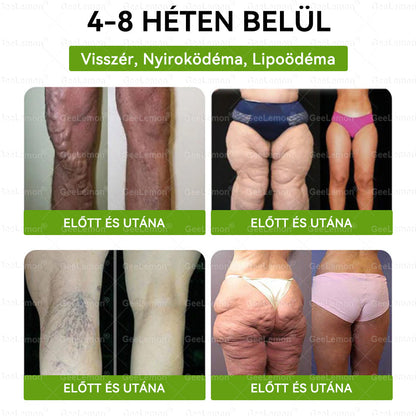 ✅✨Moringa · Berberine × NAD+ 10-in-1 Advanced Nano GeeLemon® Glumasetide 8az 1-ben Karcsú és EgészségesNano Mikrotűs Tapasz (Napi 1alkalom – látható változásakár 7 nap alatt) ✅ Elhízásra,bőrfeszesítésre,cukorbetegségre, alvásiapnoéra, ízületekre stb HU