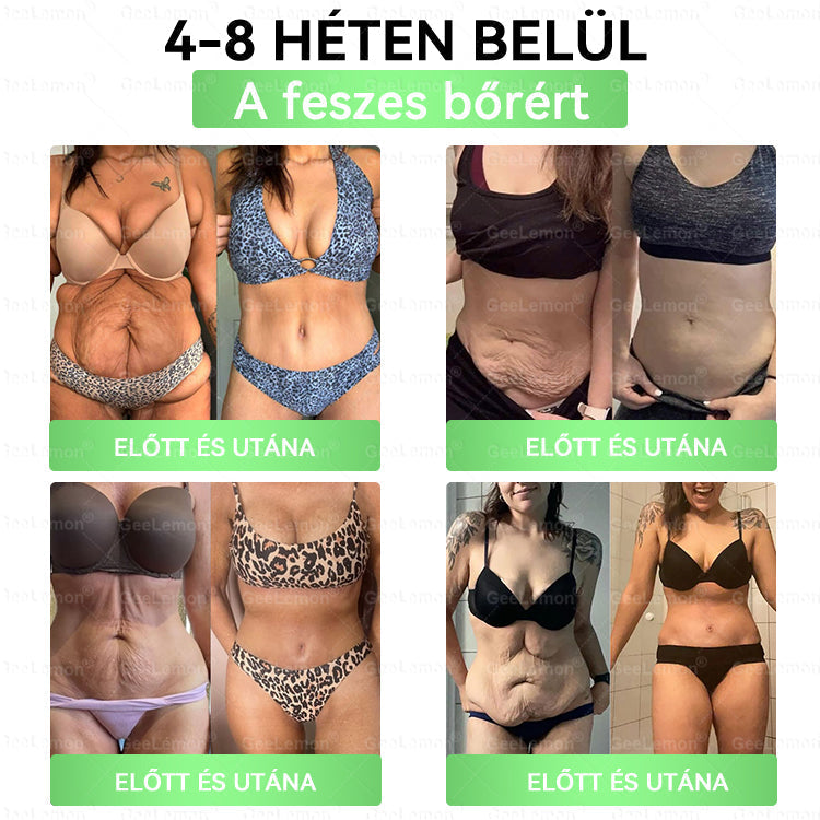 ✅✨Moringa · Berberine × NAD+ 10-in-1 Advanced Nano GeeLemon® Glumasetide 8az 1-ben Karcsú és EgészségesNano Mikrotűs Tapasz (Napi 1alkalom – látható változásakár 7 nap alatt) ✅ Elhízásra,bőrfeszesítésre,cukorbetegségre, alvásiapnoéra, ízületekre stb HU